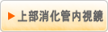 上部消化管内視鏡